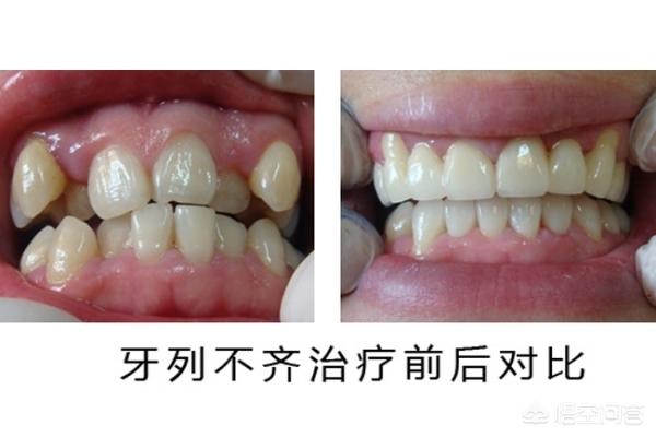 海盐最新24小时牙医在线咨询方法分析(最方便真实的海盐有没有24小时牙医方法)