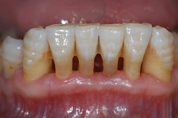 海盐最新24小时牙医在线咨询方法分析(最方便真实的海盐有没有24小时牙医方法)